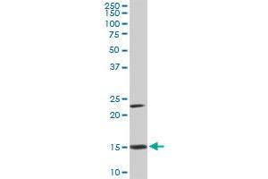 RPS17 monoclonal antibody (M01A), clone 2C7.