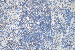 anti-Fumarate Hydratase (FH) antibody