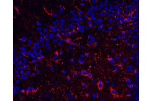 Immunofluorescence analysis of paraffin-embedded rat brain using GFAP Monoclonal Antibody at dilution of 1:400. (GFAP anticorps)