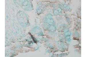 Immunohistochemistry analysis using Rabbit Anti-ERK1 Polyclonal Antibody (ABIN361832 and ABIN361833).
