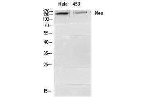 Western Blot (WB) analysis of HeLa 453 cells using Neu Polyclonal Antibody. (NEURL anticorps  (Ser357))
