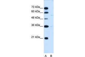 Western Blotting (WB) image for anti-Chromosome 19 Open Reading Frame 28 (C19orf28) antibody (ABIN2463998) (C19orf28 anticorps)
