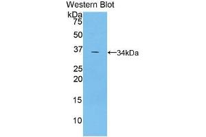 Western blot analysis of the recombinant protein. (TRAF5 anticorps  (AA 181-437))