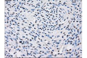 Immunohistochemical staining of paraffin-embedded colon tissue using anti-FHmouse monoclonal antibody. (FH anticorps)