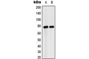 Western blot analysis of MASP2 expression in HeLa (A), SP2/0 (B) whole cell lysates. (MASP2 anticorps  (Center))