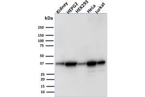 Western Blot Analysis of Human Kidney tissue, Human HepG2, HEK293, HeLa and Jurkat cell lysate using AKR1B1 Mouse Monoclonal Antibody (CPTC-AKR1B1-3). (AKR1B1 anticorps)