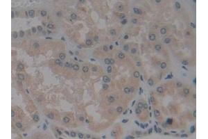 Detection of BMF in Human Kidney Tissue using Polyclonal Antibody to Bcl2 Modifying Factor (BMF)