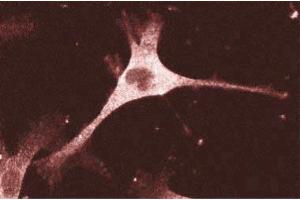 Immunofluorescence staining of human endothelial cells. (ENAH anticorps  (AA 415-541))