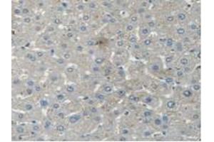 IHC-P analysis of Human Liver Tissue, with DAB staining. (STAM2 anticorps  (AA 1-377))
