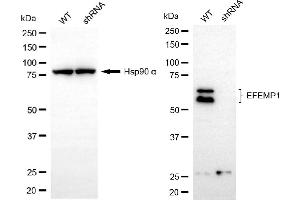 Western blotting analysis using EFEMP1 antibody (ABIN7798617).