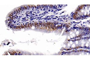 Detection of HDAC1 in Rat Colon Tissue using Monoclonal Antibody to Histone Deacetylase 1 (HDAC1)