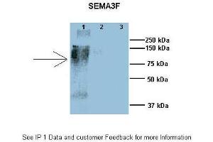 Researcher: Dr. (SEMA3F anticorps  (N-Term))