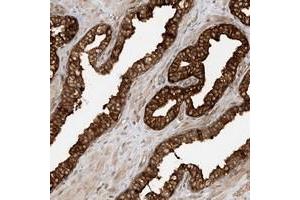 Immunohistochemical staining of human prostate with SCARF2 polyclonal antibody  strong cytoplasmic positivity in glandular cells at 1:200-1:500 dilution. (SCARF2 anticorps)
