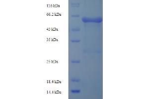 SDS-PAGE (SDS) image for Matrix Metallopeptidase 3 (Stromelysin 1, Progelatinase) (MMP3) (AA 102-477), (partial) protein (His-SUMO Tag) (ABIN4976404) (MMP3 Protein (AA 102-477, partial) (His-SUMO Tag))