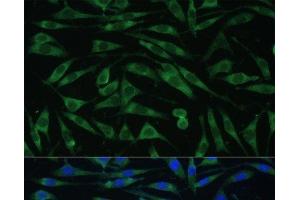 Immunofluorescence analysis of L929 cells using DNM3 Polyclonal Antibody at dilution of 1:100 (40x lens).