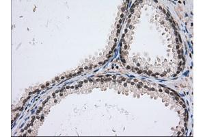 Immunohistochemical staining of paraffin-embedded Human Kidney tissue using anti-USP5 mouse monoclonal antibody. (USP5 anticorps)