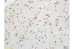 Formalin-fixed and paraffin embedded rat brain tissue labeled with Anti-Phospho-TrkA (Tyr490) /TrkB (Tyr516) Polyclonal Antibody, Unconjugated (ABIN746603) at 1:200, followed by conjugation to the secondary antibody and DAB staining (TRKA anticorps  (pTyr496))