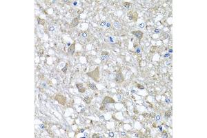 Immunohistochemistry of paraffin-embedded rat brain using VPS37A antibody (ABIN5975733) at dilution of 1/100 (40x lens).