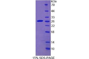 SDS-PAGE analysis of Human CYP2D6 Protein.
