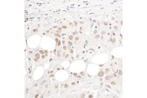 anti-hPrp3p (AA 100-150) antibody