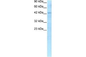 WB Suggested Anti-RBPSUH Antibody Titration: 0.