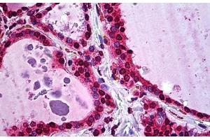 Human Thyroid: Formalin-Fixed, Paraffin-Embedded (FFPE) (ATF5 anticorps  (AA 101-200))