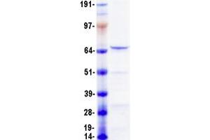 Validation with Western Blot