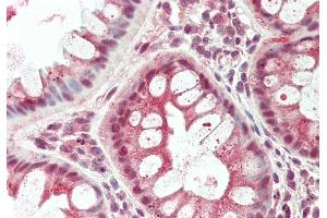 Rabbit Anti-TSC22D1 antibody Catalog Number: ARP36279 Formalin Fixed Paraffin Embedded Tissue: Human Colon Primary antibody Concentration: 1:100 Secondary Antibody: Donkey anti-Rabbit-Cy3 Secondary Antibody Concentration: 1:200 Magnification: 20x Exposure Time: 0. (TSC22D1 anticorps  (C-Term))