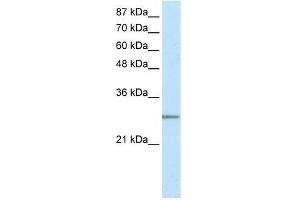 Transfected 293T; WB Suggested Anti-C20ORF20 Antibody Titration: 2. (MRGBP anticorps  (N-Term))