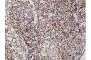 Immunoperoxidase of purified MaxPab antibody to CD2 on formalin-fixed paraffin-embedded human lymph node. (CD2 anticorps  (AA 1-351))