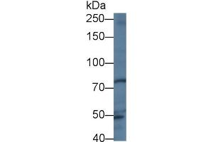 Western Blot; Sample: Human Hela cell lysate; Primary Ab: 1µg/ml Rabbit Anti-Human TRO Antibody Second Ab: 0. (TRO anticorps  (AA 444-642))