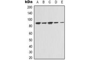 Western blot analysis of FAP alpha expression in Hela (A), MCF7 (B), NIH3T3 (C), mouse kidney (D), rat liver (E) whole cell lysates. (FAP anticorps)