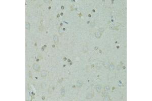 Immunohistochemistry of paraffin-embedded rat brain using GTF2H2C antibody (ABIN5973022) at dilution of 1/100 (40x lens). (GTF2H2C anticorps)