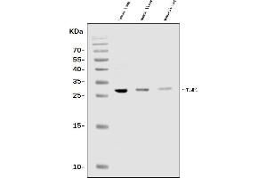 Western blot analysis of TIMP1 using anti-TIMP1 antibody (ABIN7601251).