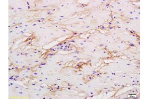Formalin-fixed and paraffin embedded human colon labeled with Rabbit Anti phospho-LRP1(Ser4523) Polyclonal Antibody, Unconjugated (ABIN801648) at 1:200 followed by conjugation to the secondary antibody and DAB staining (LRP1 anticorps  (pSer4523))