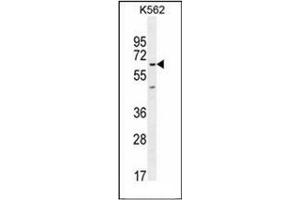 Western blot analysis of KBTBD5 Antibody (Center) in K562 cell line lysates (35ug/lane). (KBTBD5 anticorps  (Middle Region))
