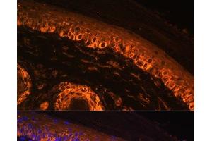 Immunofluorescence analysis of Rat skin using TYR Polyclonal Antibody at dilution of 1:100. (TYR anticorps)