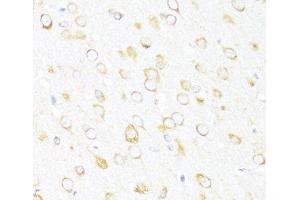 Immunohistochemistry of paraffin-embedded Rat brain using DDX3Y Polyclonal Antibody at dilution of 1:100 (40x lens). (DDX3Y anticorps)