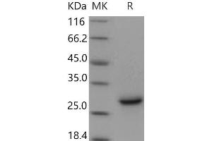 Western Blotting (WB) image for Syndecan 4 (SDC4) (AA 1-146) protein (His tag) (ABIN7320170) (SDC4 Protein (AA 1-146) (His tag))