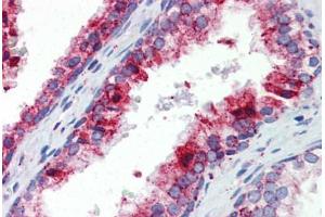Human Prostate (formalin-fixed, paraffin-embedded) stained with BCL11A antibody ABIN462216 followed by biotinylated goat anti-rabbit IgG secondary antibody ABIN481713, alkaline phosphatase-streptavidin and chromogen.
