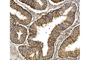 anti-Mitochondrial Import Inner Membrane Translocase Subunit Tim29 (TIMM29) (AA 37-260) antibody