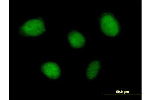 Immunofluorescence of purified MaxPab antibody to TNIP1 on HeLa cell. (TNIP1 anticorps  (AA 1-636))