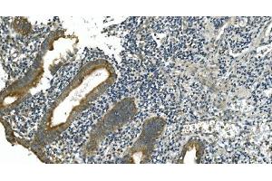 IHC analysis of CDC123 using anti-CDC123 antibody (ABIN7599284). (CDC123 anticorps  (AA 1-336))