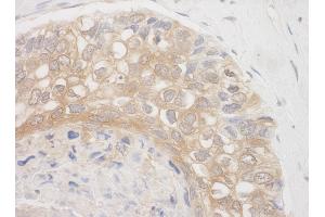 Immunohistochemistry (IHC) image for anti-BCL2-Associated Athanogene 3 (BAG3) (AA 525-575) antibody (ABIN7454868)