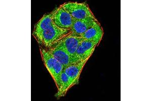 Immunofluorescence analysis of Hela cells using MECP2 mouse mAb (green). (MECP2 anticorps  (AA 7-148))