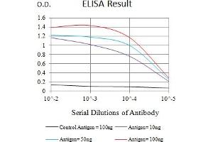 Black line: Control Antigen (100 ng),Purple line: Antigen (10 ng), Blue line: Antigen (50 ng), Red line:Antigen (100 ng)
