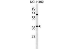 Western Blotting (WB) image for anti-NHL Repeat Containing 3 (NHLRC3) antibody (ABIN3001284) (NHLRC3 anticorps)