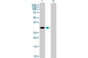 Western Blot analysis of PSMB8 expression in transfected 293T cell line by PSMB8 MaxPab polyclonal antibody. (PSMB8 anticorps  (AA 1-272))