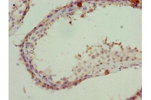 Immunohistochemistry of paraffin-embedded human testis tissue using ABIN7142198 at dilution of 1:100