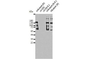 Protein sample (3 μg) from HEK 293 cells transiently transfected with mouse (m) or human (h) Robo4 cDNA vector or from untransfected cells (negative control, ctrl) on a 12% gel under reduced (R) or non- reduced condition (N.